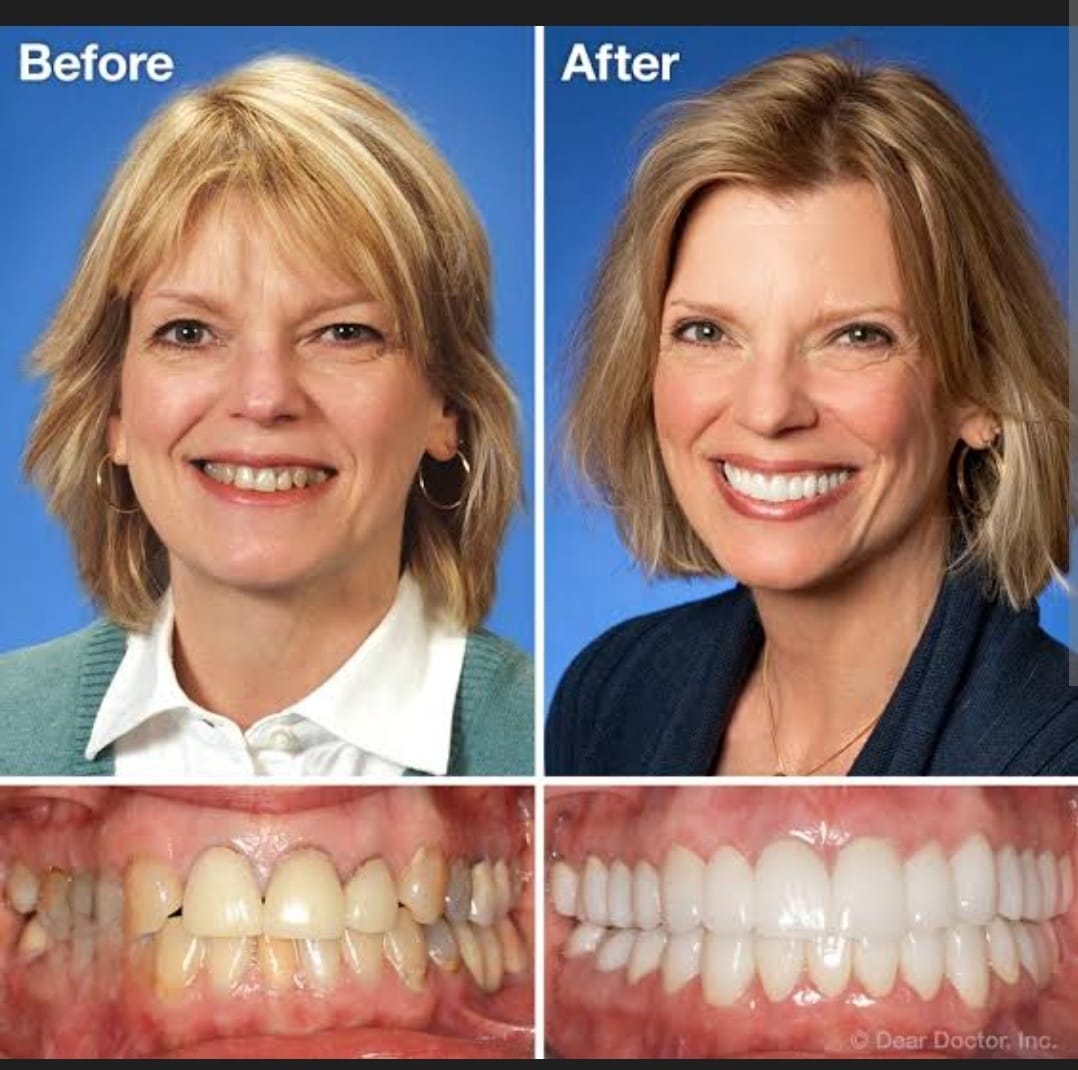 Cosmetic dental procedures