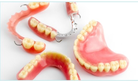 Illustration of partial and full dentures